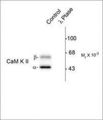 Western Blot: CaMKIIN2 [p Thr286] Antibody [NBP1-50259] - Analysis of rat brain lysate, showing specific immunolabeling of the ~50k a- and the ~60k b-CaM Kinase II phosphorylated at Thr286 (Control). The phosphospecificity of this labeling is shown in the second lane (lambda-phosphatase: l-Ptase). The blot is identical to the control except that it was incubated in l-Ptase (1200 units for 30 min) before being exposed to the Anti-Thr286 CaM Kinase II. The immunolabeling is completely eliminated by treatment with l-Ptase.